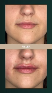 d1097c_3de5f6935d3f45cfb036015ddb70d008~mv2