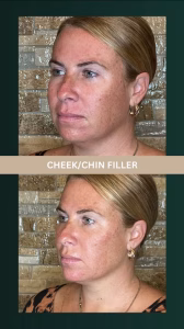 d1097c_749da477610d43e38f96fa3197d48229~mv2